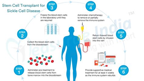 Bone Marrow Transplant For Sickle Cell Disease Credihealth