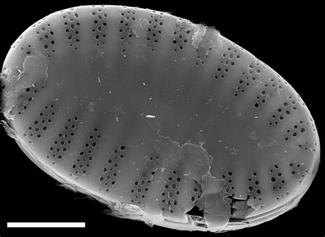 Image Ncpa026710ed Species Diatoms Of North America