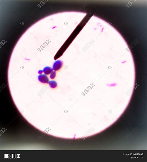 Budding Yeast Cells Under Microscope