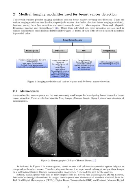 Artificial Intelligence For Breast Cancer Detection Trends Directions