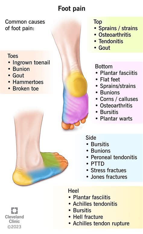 Foot Pain Causes And Treatment