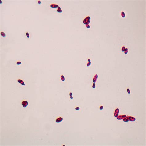 Candida Albicans Wm Microscope Slide Carolina Biological Supply