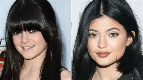 fans react to kylie jenner s fake pout after reality star finally reveals she s had fillers