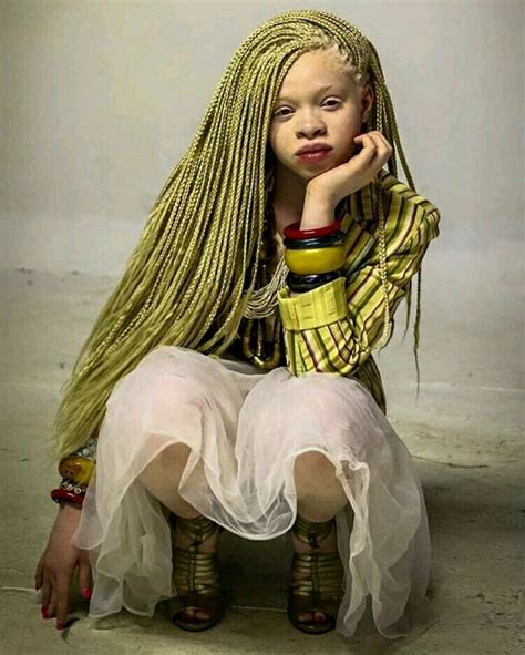 Pin By Kitty S On Haircut And African Hair Styles Albino Girl Albinism