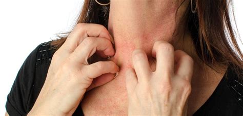 8 Common Types Of Rashes Types Of Rashes Types Of Skin Rashes Common