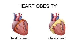 The Effects Of Obesity On Heart Know Your Heart Blog
