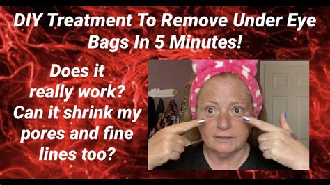 Under Eye Bag Treatment That Works In 5 Minutes Youtube