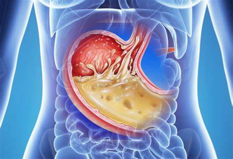 Отвары трав при диете