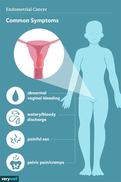 Endometrial Cancer Signs Symptoms And Complications