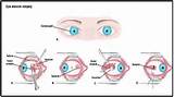 Eye Muscle Exercises For Double Vision Images