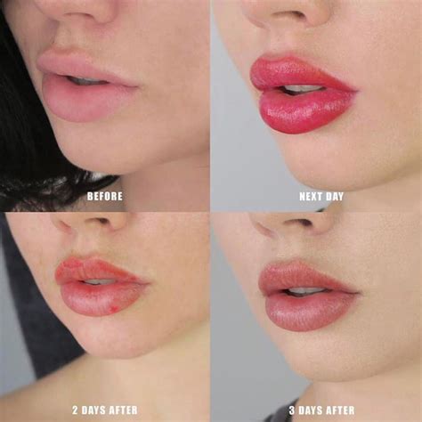 Lip Blushing Is The Cosmetic Procedure You Didn T Know You Wanted