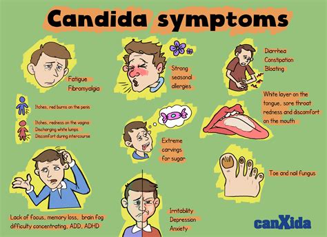 Signs And Symptoms Of Candida Candida Symptoms Candida Infection Candida