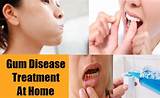 At Home Gum Disease Treatment Pictures