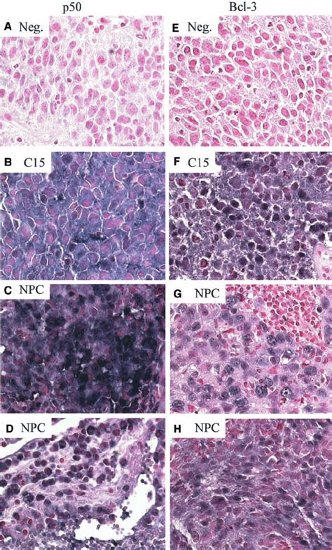 Immunohistochemical Stains Of Paraffin Embedded Tissue A C15