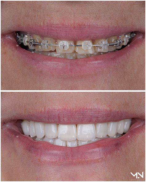 Cosmetic Dentistry Before And After Photos Helm Nejad Stanley