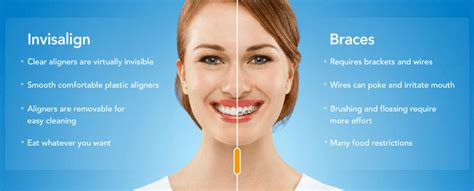 Importance Of Having Orthodontic Treatment Make Your Life Healthier