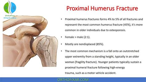 Mechanisms Of Humeral Head Fracture