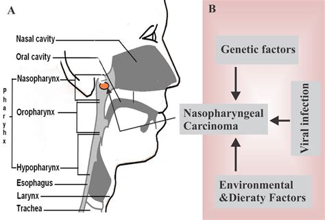 Origin And Causes Of Nasopharyngeal Carcinoma A Location Of