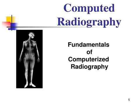 Ppt Computed Radiography And Digital Radiography Powerpoint