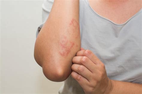 Signs You Should Ask Your Doctor About A Rash Seacoast Dermatology