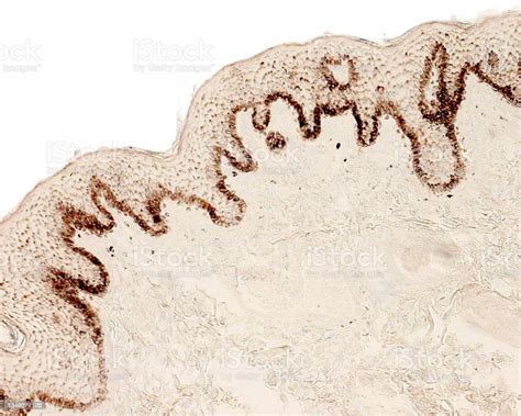 Human Skin Melanin Granules Fontana Silver Method Stock Photo