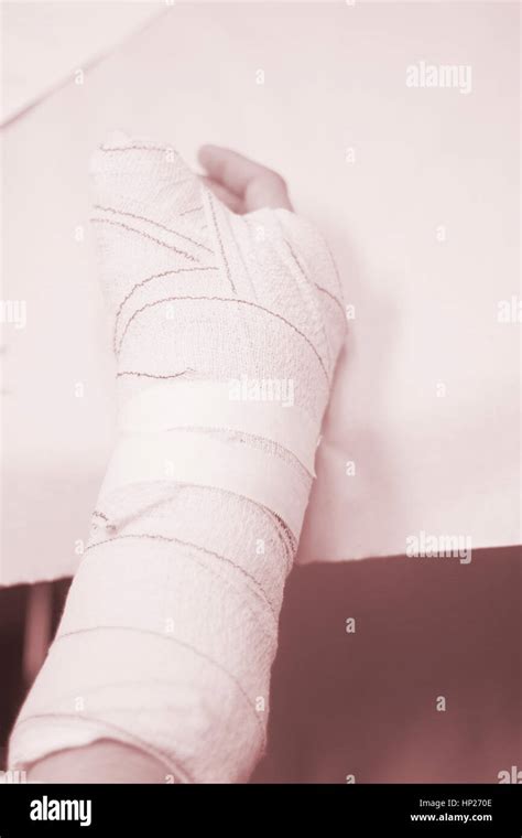 Doctor Applying A Plaster Cast And Bandages To Patient Forearm And