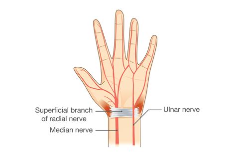What Happens If You Cut Or Damage A Nerve In Your Finger