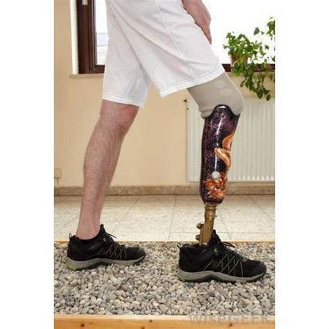 Artificial Leg Above Knee Prosthesis Manufacturer From Hyderabad