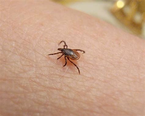 What To Know To Keep Yourself Safe From Tick Illnesses As Lyme Cases Double