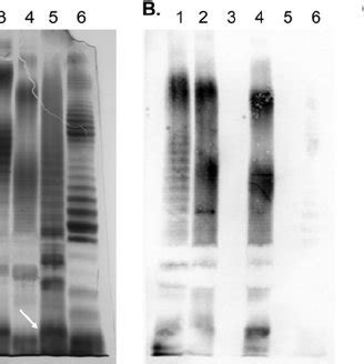 Silver Staining A And Western Blot Profiles With MAbs A68 10A06 B11