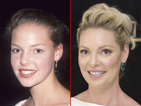 Katherine Heigl Plastic Surgery My Xxx Hot Girl