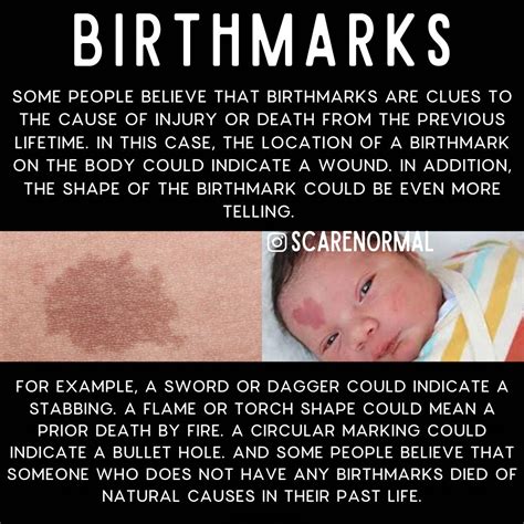 Why Do People Have Birthmarks Religions Facts