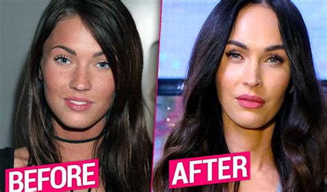 megan fox plastic surgery transformation revealed by top doctors