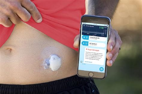 All About The Medtronic Guardian Connect Continuous Glucose Monitor