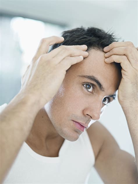 Natural Treatments For Hair Loss In Men
