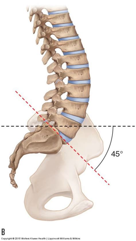 Lower Crossed Syndrome Postural Distortion Pattern