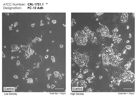 3t3 l1 accumulates triglyceride fat to a lesser extent than 3t3 f442a. PC12 cell line - Alchetron, The Free Social Encyclopedia