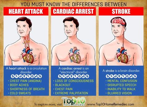 Learn what causes a cardiac arrest and how cpr can help save someone's life. difference between heart attack, stroke and cardiac arrest ...