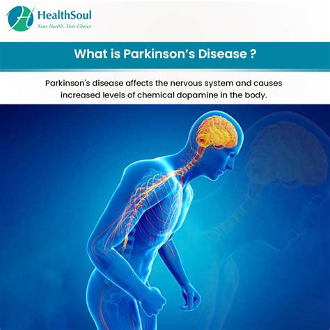 Parkinson’s Disease Symptoms Diagnosis And Treatment Healthsoul