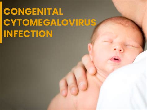 Congenital Cytomegalovirus Cmv Infection Causes Symptoms Risk