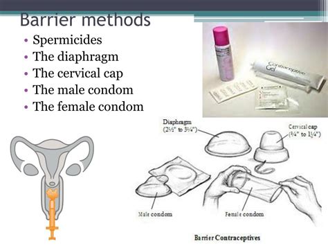 Ppt Contraceptives Powerpoint Presentation Free Download Id2176478