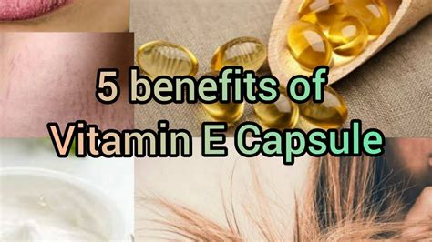 Check out its top benefits for your hair and skin. 5 Top Benefits of Vitamin E Capsules||Benefits for skin ...