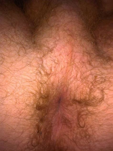 Naked Male Ginger Ass