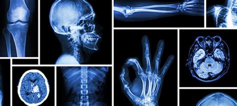 Radiology Is A Medical Specialty That Employs The Use Of An Array Of