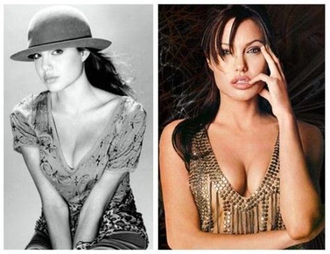 Pin On Angelina Jolie Plastic Surgery And Breast Implant Before And