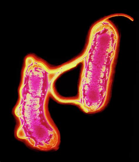 Two Helicobacter Pylori Bacteria Photograph By Ab Dowsettscience