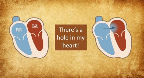 Pfo Patients Guide To Holes In The Heart Myheart