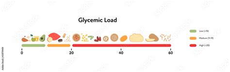 Glycemic Load Infographic For Diabetics Concept Vector Flat Diabetes Healthcare Illustration