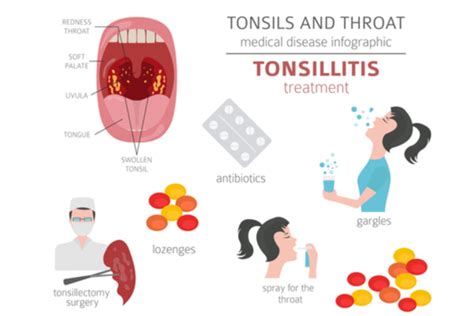 Tonsillitis In Kids Symptoms Causes Diagnosis And Treatment