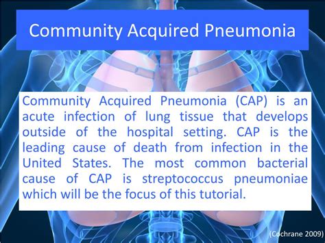 Ppt Community Acquired Pneumonia Powerpoint Presentation Free